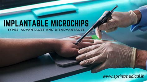 rfid chip implants|Microchip implant (human) .